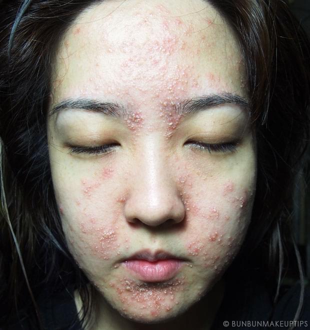 Chang Skincare